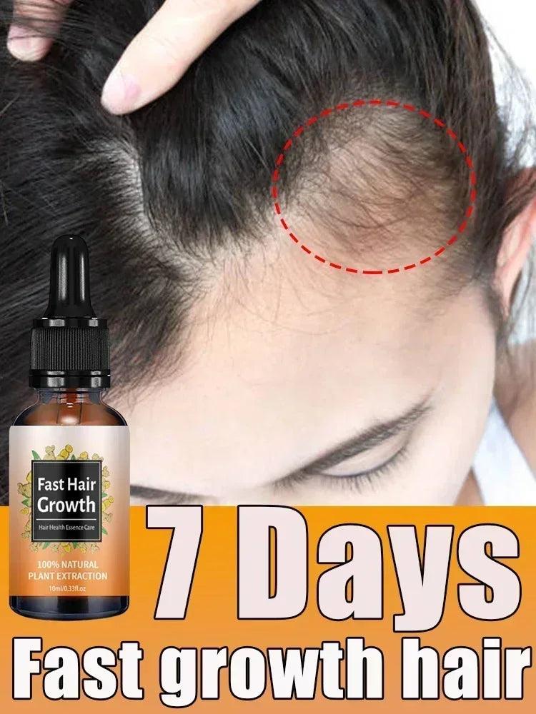 Ginger Fast Hair Loss Treatment Biotin Hair Growth Oil - Dabfavshop